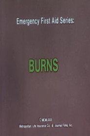 Emergency First Aid Series: Burns